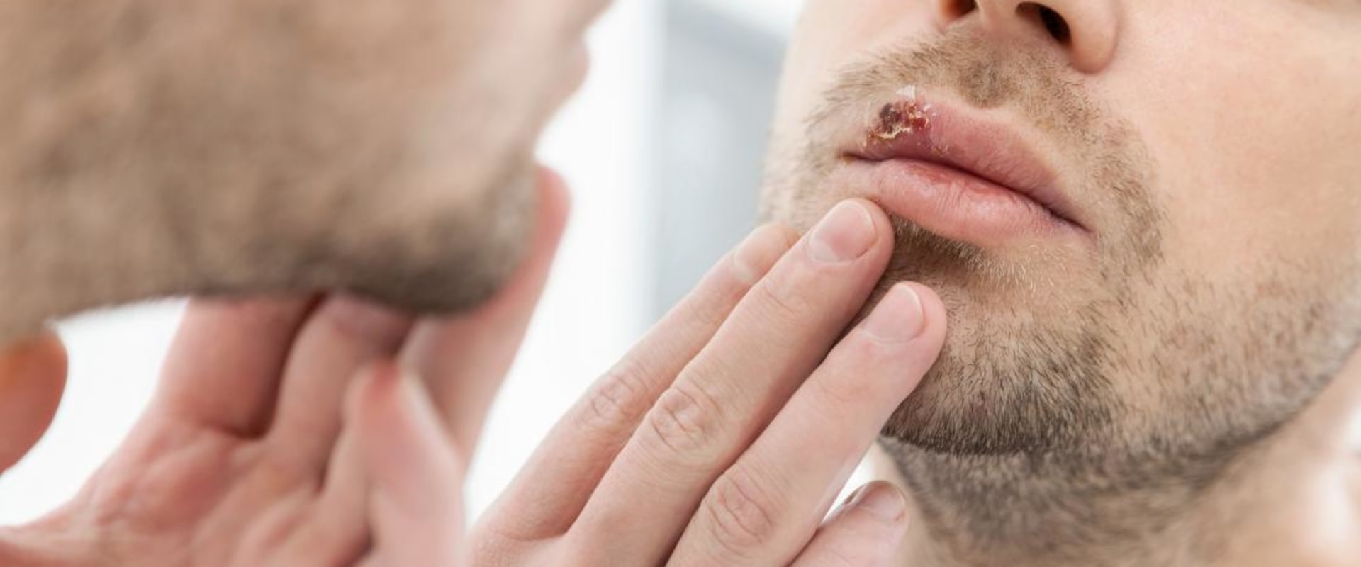 Is a Herpes Cure on the Horizon?